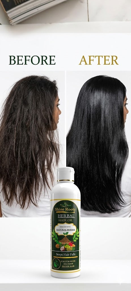 Hair Fall Control. Shine Rootz Herbal Hair Oil