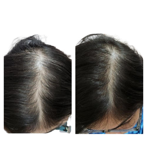 Before and after comparison of hair with white patches on a white background
